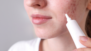 Leke Bakımı | Görsel: Canva